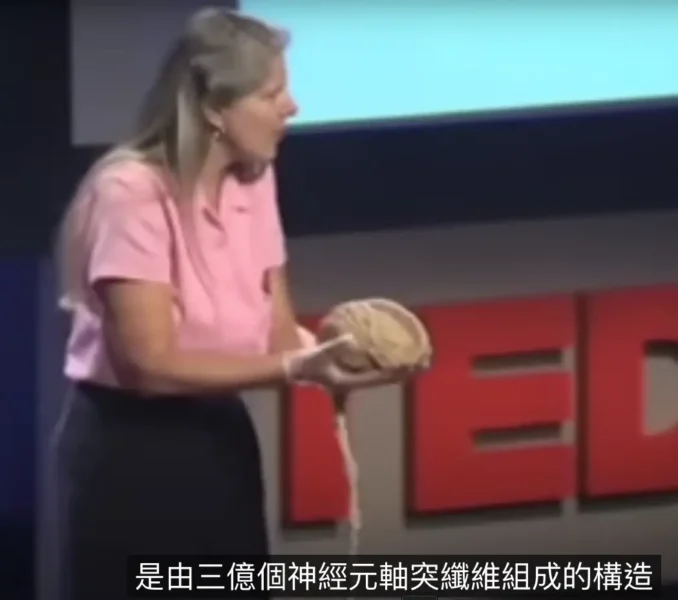 My stroke of insight Jill Bolte Taylor TED l x